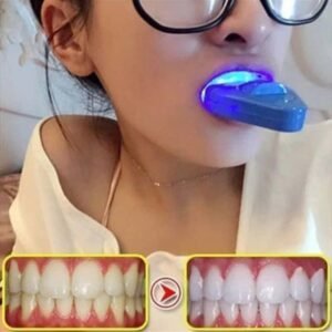 Kit de Blanchiment Dentaire à Domicile avec Lampe LED et Accessoires